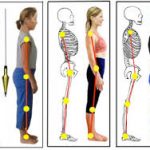 Posture Correction Personal Trainer In London